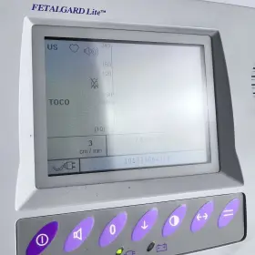 10-43421-003 Analogic Fetalgard Lite Plus With Printer #2