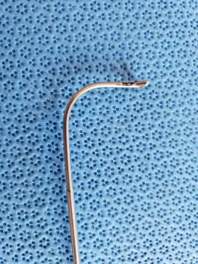 93-5756 Boss Kuhn-bolger Double Spoon Giraffe Forceps Instrument Stainless Steel #3