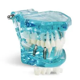 380184 Denshine Dental Study Adult Pathological Teeth Model - Transparent #2