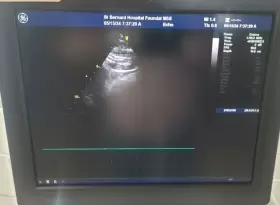 R2418295-2 Ge Vivid E9 Ultrasound With One Probe M5s-d #2