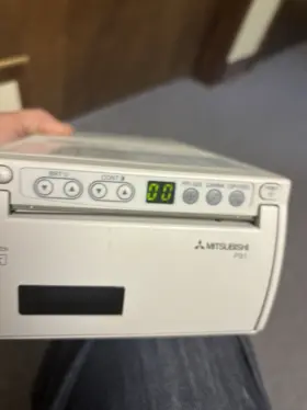 Eus-405 Hitachi Plus With Probe Printer And Carrying Case Rarely Used #3