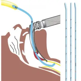 9-0212-72 Sunmed Bougie Tracheal Tube Introducer 15 Fr. X 70 Cm Sterile - 10/box