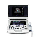 Edan Acclarix AX3 Diagnostic Ultrasound System. Fixed Price $15593.99.