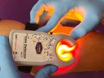 Scimed's Vein Detector Illuminator Viewer Rechargeable. Fixed Price $149.41.
