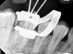 Carestream Rvg 6200 Dental Digital Sensor Size ( Read Details + Images). Fixed Price $1575.00.