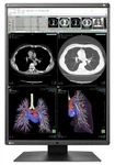 Brand New Siemens 11171870 Monitor Color 21.3" Radiforce RX360-SI. Fixed Price $3700.00.