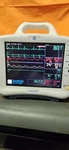 Ge Dash 3000 Patient Monitor. Fixed Price $650.00.