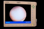 Hologic THS-01472 Hysteroscopy Video System. Fixed Price $750.00.
