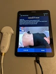 Echonous Bladder Scanner With Probe P005600, Power Supply - Parts. Fixed Price $237.15.