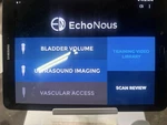 Echonous Bladder Scanner With Probe P005600 And Power Supply. Fixed Price $799.99.