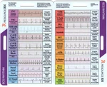 Ekg Rhythm Interpretation Reference Card - Compact & Portable Guide. Fixed Price $32.90.
