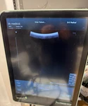 Bk Medical-ultrasound Probe, Transducer 8826. Fixed Price $12999.00.