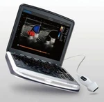Chison Sonobook 6 Color Doppler Ultrasound Linear Array Probe-top Quality 7-18MH. Fixed Price $14999.00.