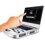 New! Edan Acclarix AX3 Digital Ultrasound Imaging System, 15" Color Touch Screen. Fixed Price $13800.00.