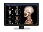 Barco Coronis Fusion MDCC-6530 6MP 30" Color Radiology Monitor (K9602943) New. Fixed Price $5500.00.