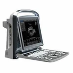 Chison ECO1 Portable Ultrasound Machine. Fixed Price $4999.00.